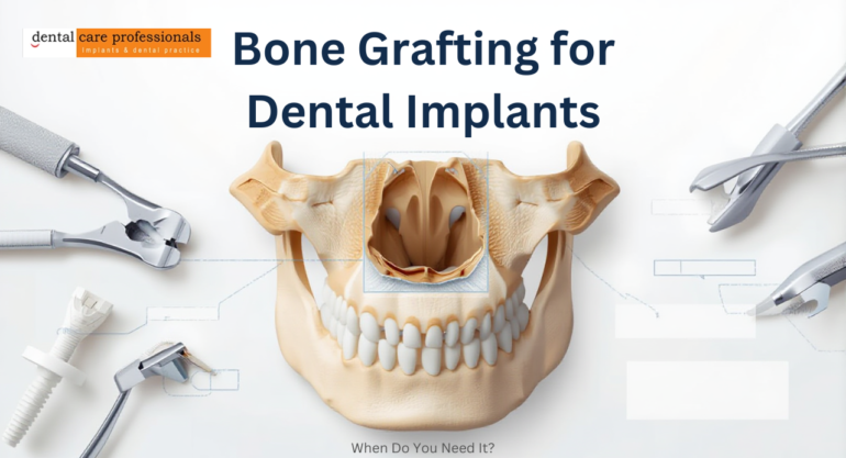Bone grafting procedure explained for dental implants using a jawbone model